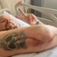 Christoph in hospital bed after the surgery
